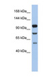 TLR9 Antibody - TLR9 antibody Western blot of ACHN lysate. This image was taken for the unconjugated form of this product. Other forms have not been tested.
