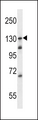 TLR9 Antibody - TLR9 Antibody western blot of Ramos cell line lysates (35 ug/lane). The TLR9 antibody detected the TLR9 protein (arrow).