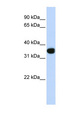 TLX1 / HOX11 Antibody - TLX1 antibody Western blot of Fetal Heart lysate. This image was taken for the unconjugated form of this product. Other forms have not been tested.