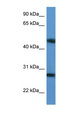 TM2D2 Antibody - TM2D2 antibody Western blot of Jurkat lysate.  This image was taken for the unconjugated form of this product. Other forms have not been tested.