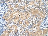 TM4SF9 / TSPAN5 Antibody - TSPAN5 antibody TSPAN5(tetraspanin 5) Antibody was used in IHC to stain formalin-fixed, paraffin-embedded human kidney.  This image was taken for the unconjugated form of this product. Other forms have not been tested.