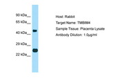 TMBIM4 / GAAP Antibody -  This image was taken for the unconjugated form of this product. Other forms have not been tested.