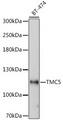 TMC5 Antibody - Western blot analysis of extracts of BT-474 cells using TMC5 Polyclonal Antibody at dilution of 1:1000.