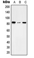 TMC7 Antibody - Western blot analysis of TMC7 expression in THP1 (A); NIH3T3 (B); H9C2 (C) whole cell lysates.
