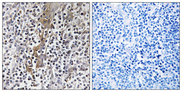 TMC8 / EVER2 Antibody - Immunohistochemistry analysis of paraffin-embedded human tonsil, using TMC8 Antibody. The picture on the right is blocked with the synthesized peptide.