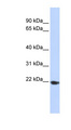 TMED1 / ST2L Antibody - TMED1 antibody Western blot of 293T cell lysate. This image was taken for the unconjugated form of this product. Other forms have not been tested.