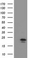 TMED1 / ST2L Antibody - HEK293T cells were transfected with the pCMV6-ENTRY control (Left lane) or pCMV6-ENTRY TMED1 (Right lane) cDNA for 48 hrs and lysed. Equivalent amounts of cell lysates (5 ug per lane) were separated by SDS-PAGE and immunoblotted with anti-TMED1.