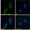 TMED10 / TMP21 Antibody - TMED10 / TMP21 antibody immunofluorescence analysis of paraformaldehyde fixed U251 cells, permeabilized with 0.15% Triton. Primary incubation 1hr (10ug/ml) followed by Alexa Fluor 488 secondary antibody (2ug/ml), showing Golgi/cytoplasmic staining. The nuclear stain is DAPI (blue). Negative control: Unimmunized goat IgG (10ug/ml) followed by Alexa Fluor 488 secondary antibody (2ug/ml).