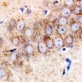 TMED10 / TMP21 Antibody - Immunohistochemical analysis of TMP21 staining in mouse brain formalin fixed paraffin embedded tissue section. The section was pre-treated using heat mediated antigen retrieval with sodium citrate buffer (pH 6.0). The section was then incubated with the antibody at room temperature and detected using an HRP conjugated compact polymer system. DAB was used as the chromogen. The section was then counterstained with hematoxylin and mounted with DPX.