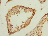 TMED10 / TMP21 Antibody - Immunohistochemistry of paraffin-embedded human testis tissue at dilution 1:100