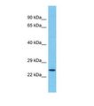 TMED5 Antibody - Western blot of Human Jurkat. TMED5 antibody dilution 1.0 ug/ml.  This image was taken for the unconjugated form of this product. Other forms have not been tested.