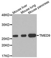 TMED9 Antibody - Western blot analysis of extracts of various cell lines, using TMED9 antibody.