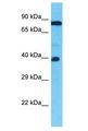 TMEFF1 / Tomoregulin 1 Antibody - TMEFF1 antibody Western Blot of 786-0. Antibody dilution: 1 ug/ml.  This image was taken for the unconjugated form of this product. Other forms have not been tested.