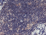 TMEFF2 Antibody - IHC of paraffin-embedded Human lymphoma tissue using anti-TMEFF2 mouse monoclonal antibody.