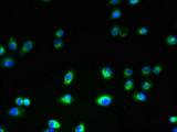 TMEM106A Antibody - Immunofluorescent analysis of A2780 cells using TMEM106A Antibody at dilution of 1:100 and Alexa Fluor 488-congugated AffiniPure Goat Anti-Rabbit IgG(H+L)