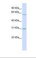 TMEM106C Antibody - Placenta lysate. Antibody concentration: 1.0 ug/ml. Gel concentration: 12%.  This image was taken for the unconjugated form of this product. Other forms have not been tested.