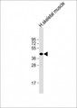 TMEM115 Antibody - Anti-TMEM115 Antibody (C-Term) at 1:2000 dilution + human skeletal muscle lysate Lysates/proteins at 20 ug per lane. Secondary Goat Anti-Rabbit IgG, (H+L), Peroxidase conjugated at 1:10000 dilution. Predicted band size: 38 kDa. Blocking/Dilution buffer: 5% NFDM/TBST.