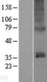 TMEM115 Protein - Western validation with an anti-DDK antibody * L: Control HEK293 lysate R: Over-expression lysate