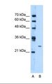 TMEM126B Antibody - Lane A: Marker. Lane B: Jurkat cell lysate. Antibody concentration: 1.25 ug/ml. Gel concentration: 12%.  This image was taken for the unconjugated form of this product. Other forms have not been tested.