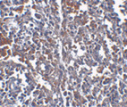TMEM142A / ORAI1 Antibody - Immunohistochemistry of ORAI1 in human spleen tissue with ORAI1 antibody at 2.5 ug/ml.