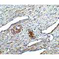 TMEM142A / ORAI1 Antibody - Immunohistochemistry of ORAI1 in human ovary tissue with ORAI1 antibody at 2.5 µg/ml.