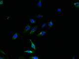 TMEM159 Antibody - Immunofluorescent analysis of HepG2 cells using TMEM159 Antibody at dilution of 1:100 and Alexa Fluor 488-congugated AffiniPure Goat Anti-Rabbit IgG(H+L)