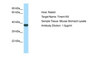 TMEM165 Antibody -  This image was taken for the unconjugated form of this product. Other forms have not been tested.