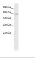 TMEM175 / MGC4618 Antibody - HepG2 Cell Lysate.  This image was taken for the unconjugated form of this product. Other forms have not been tested.