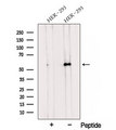 TMEM175 / MGC4618 Antibody - Western blot analysis of extracts of HEK293 cells using TMEM175 antibody. The lane on the left was treated with blocking peptide.