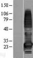TMEM176A / HCA112 Protein - Western validation with an anti-DDK antibody * L: Control HEK293 lysate R: Over-expression lysate