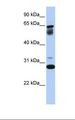 TMEM187 Antibody - 721_B cell lysate. Antibody concentration: 1.0 ug/ml. Gel concentration: 12%.  This image was taken for the unconjugated form of this product. Other forms have not been tested.