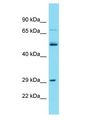 TMEM199 Antibody - TMEM199 antibody Western Blot of Jurkat. Antibody dilution: 1 ug/ml.  This image was taken for the unconjugated form of this product. Other forms have not been tested.