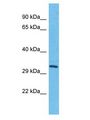 TMEM202 Antibody - TMEM202 antibody Western Blot of HepG2. Antibody dilution: 1 ug/ml.  This image was taken for the unconjugated form of this product. Other forms have not been tested.