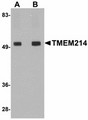 TMEM214 / FLJ20254 Antibody - Western blot of TMEM214 in rat brain tissue lysate with TMEM214 antibody at (A) 1 and (B) 2 ug/ml.
