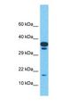 TMEM220 Antibody - Western blot of TMEM220 Antibody with human Uterus Tumor lysate.  This image was taken for the unconjugated form of this product. Other forms have not been tested.