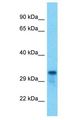 TMEM221 Antibody - TMEM221 antibody Western Blot of HCT15. Antibody dilution: 1 ug/ml.  This image was taken for the unconjugated form of this product. Other forms have not been tested.