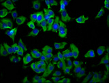 TMEM231 Antibody - Immunofluorescence staining of MCF-7 cells diluted at 1:66, counter-stained with DAPI. The cells were fixed in 4% formaldehyde, permeabilized using 0.2% Triton X-100 and blocked in 10% normal Goat Serum. The cells were then incubated with the antibody overnight at 4°C.The Secondary antibody was Alexa Fluor 488-congugated AffiniPure Goat Anti-Rabbit IgG (H+L).