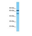 TMEM232 Antibody - Western blot of Human MDA-MB-435S. TMEM232 antibody dilution 1.0 ug/ml.  This image was taken for the unconjugated form of this product. Other forms have not been tested.