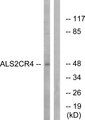 TMEM237 / ALS2CR4 Antibody - Western blot analysis of lysates from Jurkat cells, using ALS2CR4 Antibody. The lane on the right is blocked with the synthesized peptide.