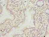 TMEM243 Antibody - Immunohistochemistry of paraffin-embedded human small intestine tissue using antibody at dilution of 1:100.