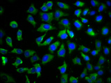 TMEM26 Antibody - Immunofluorescence staining of A549 cells diluted at 1:100, counter-stained with DAPI. The cells were fixed in 4% formaldehyde, permeabilized using 0.2% Triton X-100 and blocked in 10% normal Goat Serum. The cells were then incubated with the antibody overnight at 4°C.The Secondary antibody was Alexa Fluor 488-congugated AffiniPure Goat Anti-Rabbit IgG (H+L).