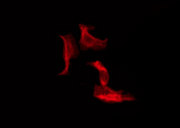 TMEM30B Antibody - Staining HeLa cells by IF/ICC. The samples were fixed with PFA and permeabilized in 0.1% Triton X-100, then blocked in 10% serum for 45 min at 25°C. The primary antibody was diluted at 1:200 and incubated with the sample for 1 hour at 37°C. An Alexa Fluor 594 conjugated goat anti-rabbit IgG (H+L) Ab, diluted at 1/600, was used as the secondary antibody.