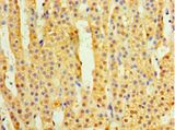TMEM44 Antibody - Immunohistochemistry of paraffin-embedded human adrenal gland using antibody at 1:100 dilution.  This image was taken for the unconjugated form of this product. Other forms have not been tested.
