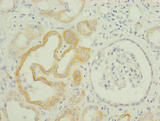 TMEM61 Antibody - Immunohistochemistry of paraffin-embedded human kidney tissue using TMEM61 Antibody at dilution of 1:100