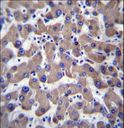 TMEM70 Antibody - TMM70 Antibody immunohistochemistry of formalin-fixed and paraffin-embedded human liver tissue followed by peroxidase-conjugated secondary antibody and DAB staining.