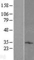 TMEM71 Protein - Western validation with an anti-DDK antibody * L: Control HEK293 lysate R: Over-expression lysate