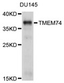 TMEM74 Antibody - Western blot analysis of extracts of DU145 cells, using TMEM74 antibody at 1:1000 dilution. The secondary antibody used was an HRP Goat Anti-Rabbit IgG (H+L) at 1:10000 dilution. Lysates were loaded 25ug per lane and 3% nonfat dry milk in TBST was used for blocking. An ECL Kit was used for detection and the exposure time was 90s.