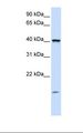 TMEM79 Antibody - Placenta lysate. Antibody concentration: 1.0 ug/ml. Gel concentration: 12%.  This image was taken for the unconjugated form of this product. Other forms have not been tested.