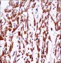 TMEM85 Antibody - TMM85 Antibody immunohistochemistry of formalin-fixed and paraffin-embedded human heart tissue followed by peroxidase-conjugated secondary antibody and DAB staining.