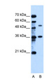TMEM8B / NGX6 Antibody - TMEM8B / C9orf127 antibody ARP41903_T100-NP_001036054-C9ORF127 Antibody Western blot of HepG2 cell lysate.  This image was taken for the unconjugated form of this product. Other forms have not been tested.